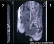 X-Ray - BlowJob from the first x ray deepthroat and fucking compilation hot