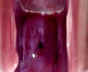 Cervix Throbbing and Flowing Oozing Cum During Close Up Speculum Play from pussy datail video